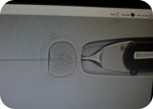 Fertilização In Vitro (FIV)