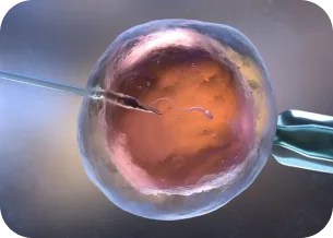 ICSI (Injeção Intracitoplasmática de Espermatozoide)
