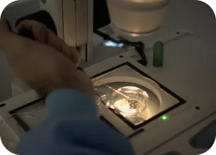 Inseminação Artificial Intrauterina (IIU)
